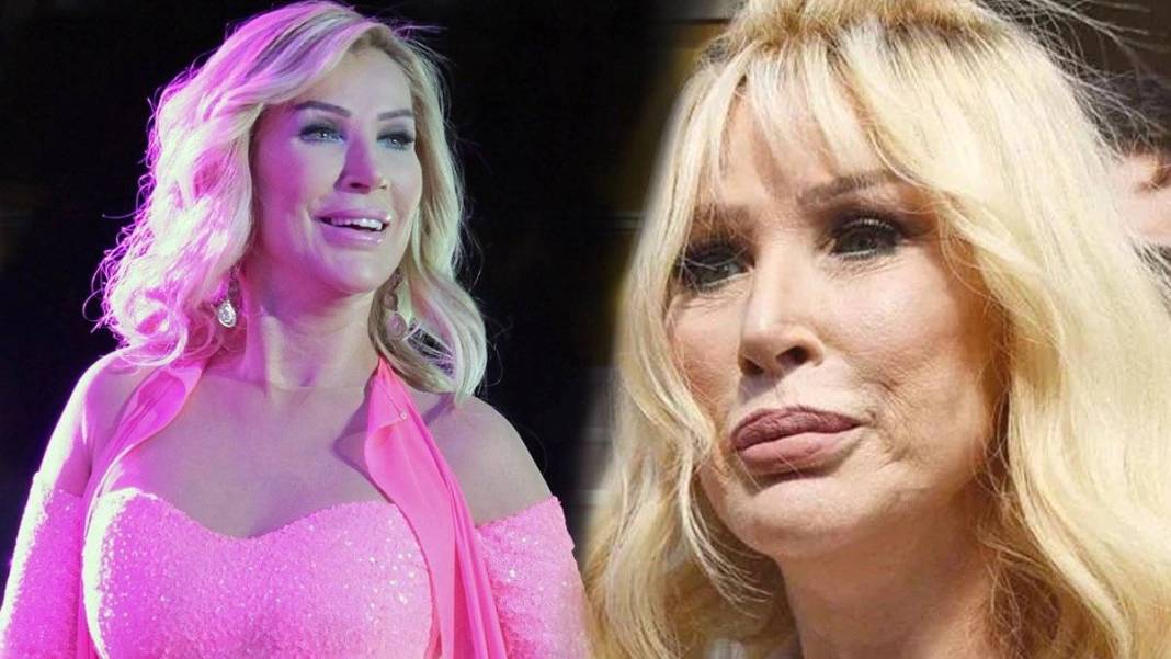 Estetik mi photoshop mu? Seda Sayan'ı görenler tanıyamadı: Abla sana ne oldu? 4